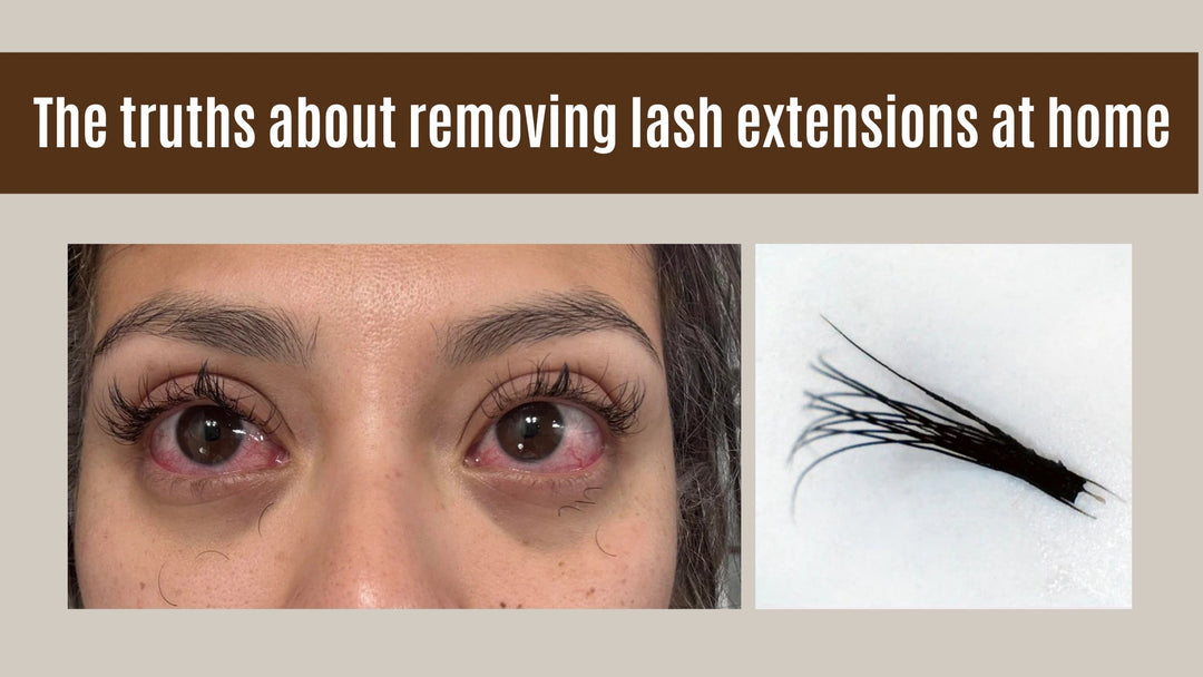 Woman with red, irritated eyes next to a removed lash cluster and text about at-home lash removal risks